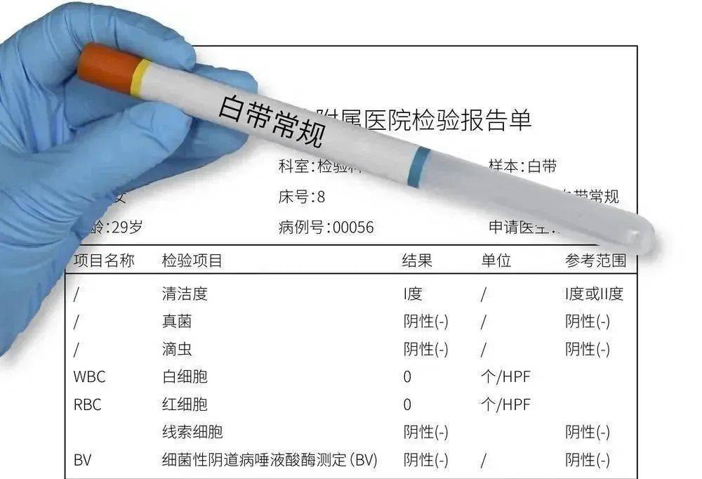 宫颈癌筛查包括:hpv(人乳头瘤病毒)检测和tct